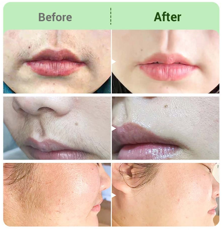 📢🌸Kaufen  3 und erhalten 5 gratis✨Haarentfernungscreme-Set für Frauen🌸