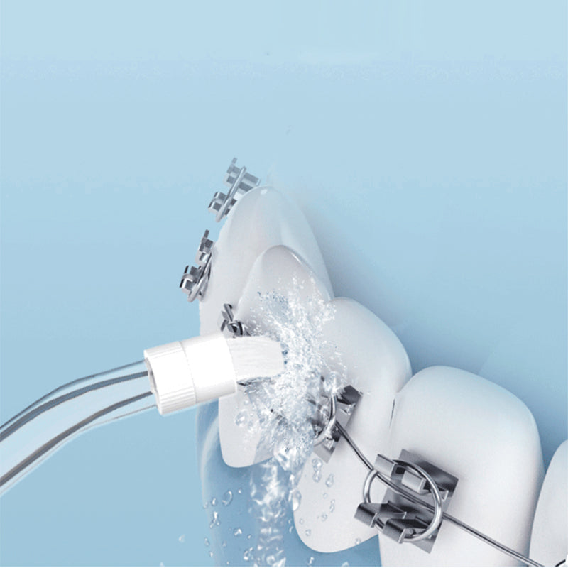 💦🦷 HEISSER SALE: 50% RABATT! Tragbare Munddusche – Wasserdruck-Regulierung, 3 Aufsätze & USB-Aufladbar für eine gründliche Mundhygiene ✨