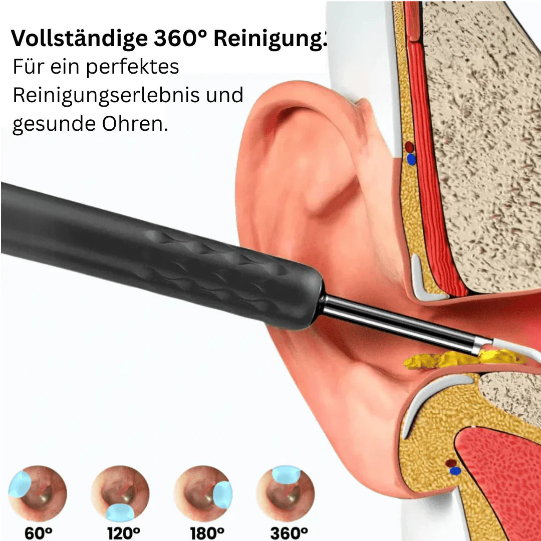 ✨✨🏆💥Intelligenter wasserdichter visueller Ohrenschmalzentferner