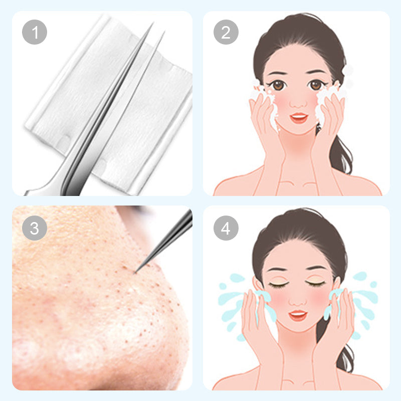 ✨🔧 50% RABATT! Edelstahl-Set zum Entfernen von Mitessern – Profi-Hautpflege-Werkzeugset, rostfrei & steril – Für saubere, gründliche Reinigung ✨